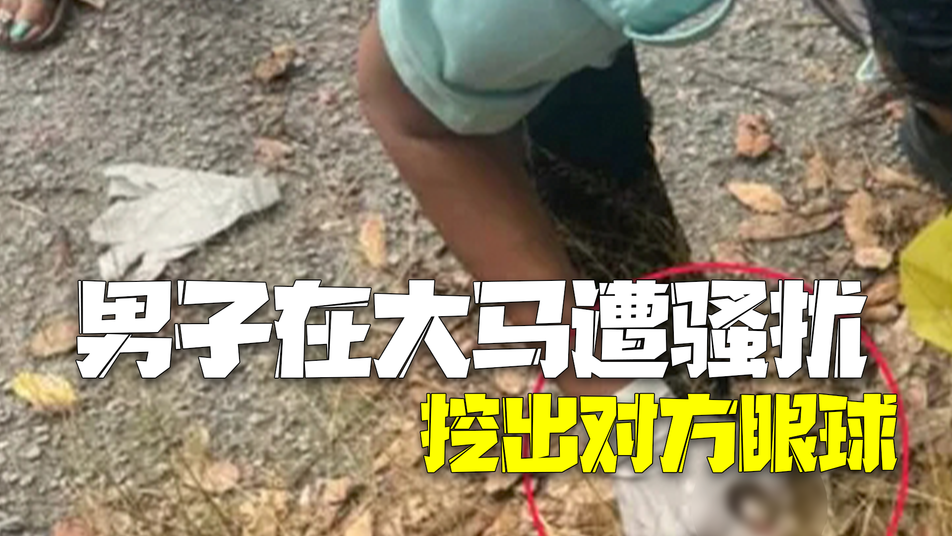 男子在马来西亚遭醉汉骚扰：竟将其左眼球挖出！