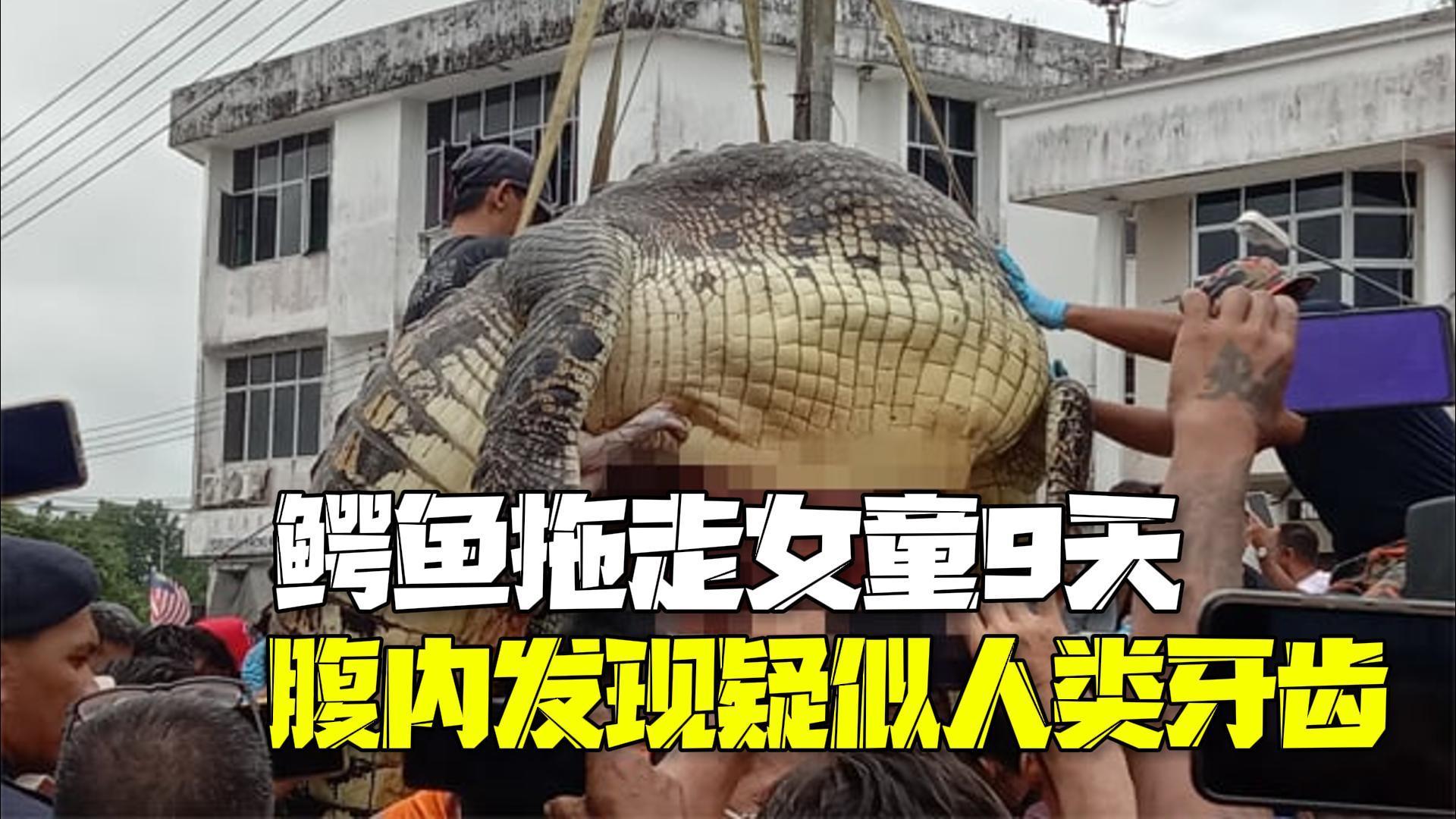 马来西亚一鳄鱼拖走女童9天被捕获 腹内发现四颗疑似人类牙齿 马来西亚一鳄鱼拖走女童9天被捕获 腹内发现四颗疑似人类牙齿