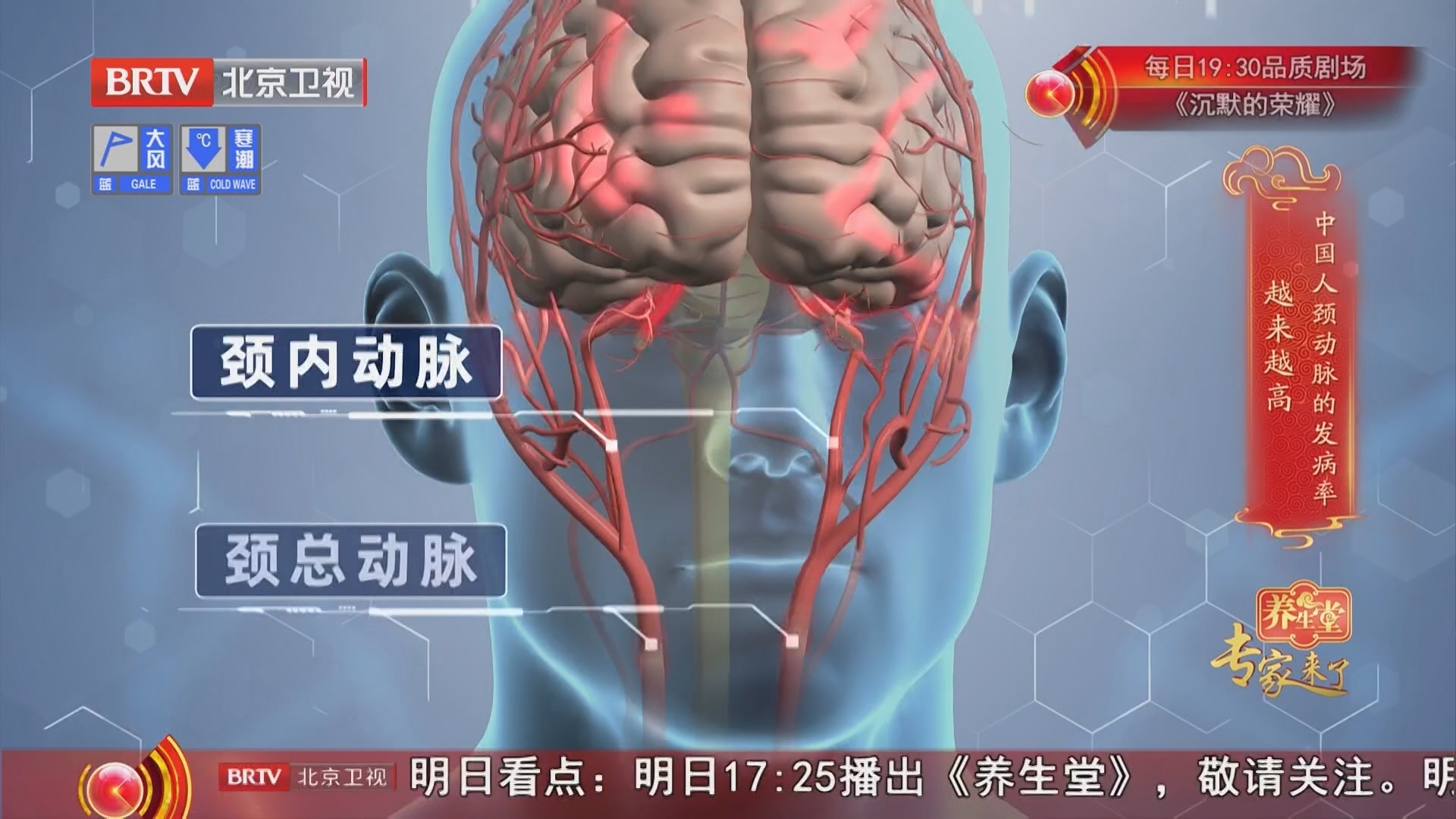 《养生堂》20251017防中风做对选择题