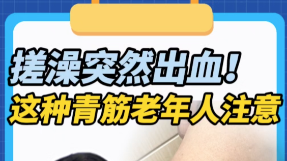 男子搓澡时突然出血！临床上常见于老年患者，这类“青筋”千万别忽视