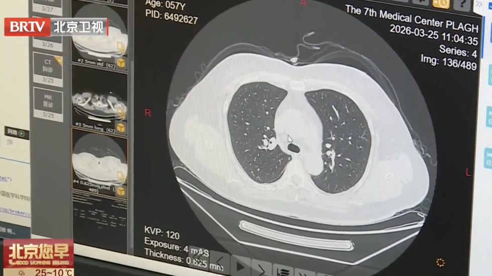 早期无症状,一查就是晚期?专家提醒:定期体检很重要! 早期无症状,一查就是晚期?专家提醒:定期体检很重要!