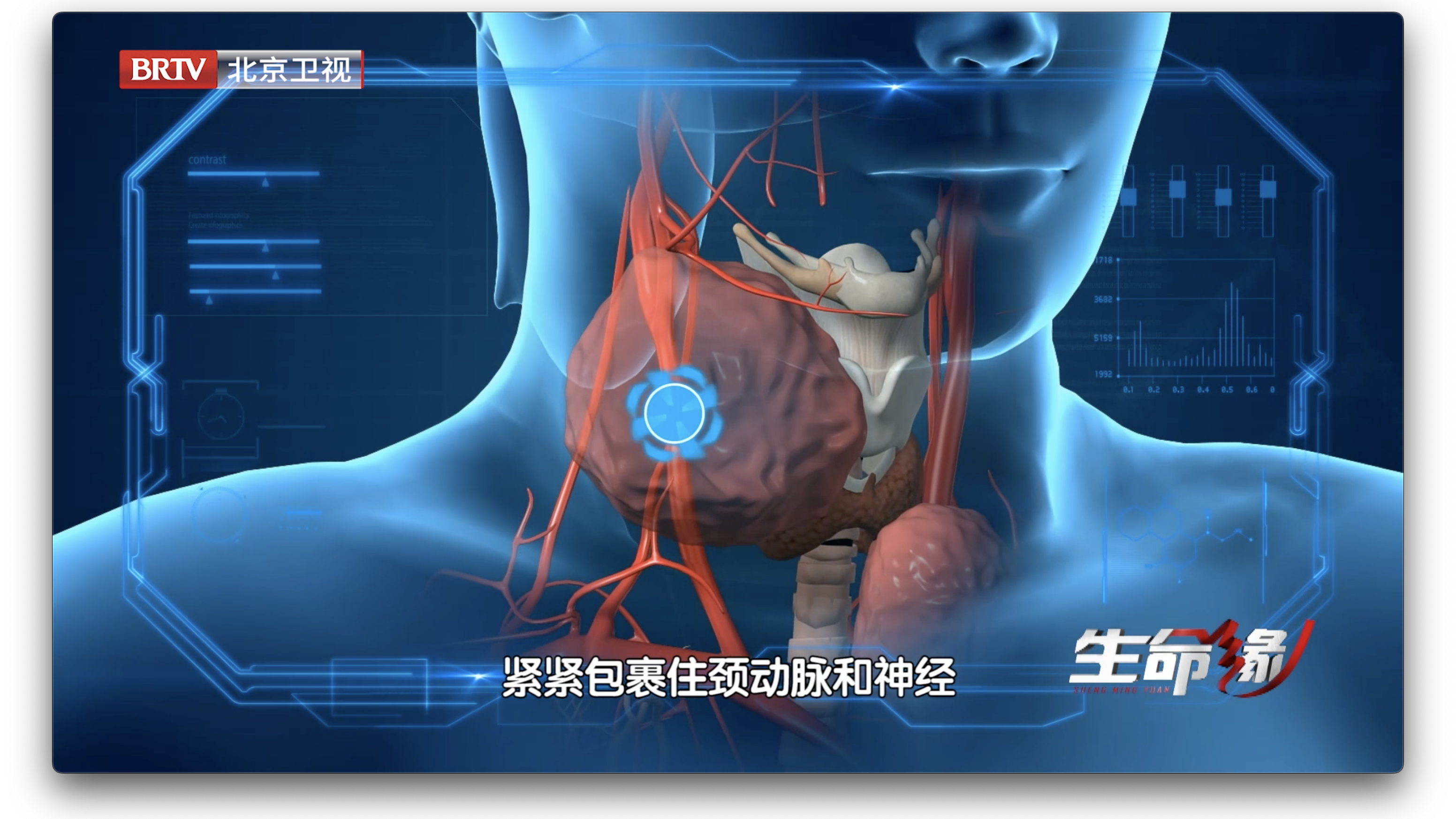 10厘米肿瘤每天都在增长，患者生命遭受威胁