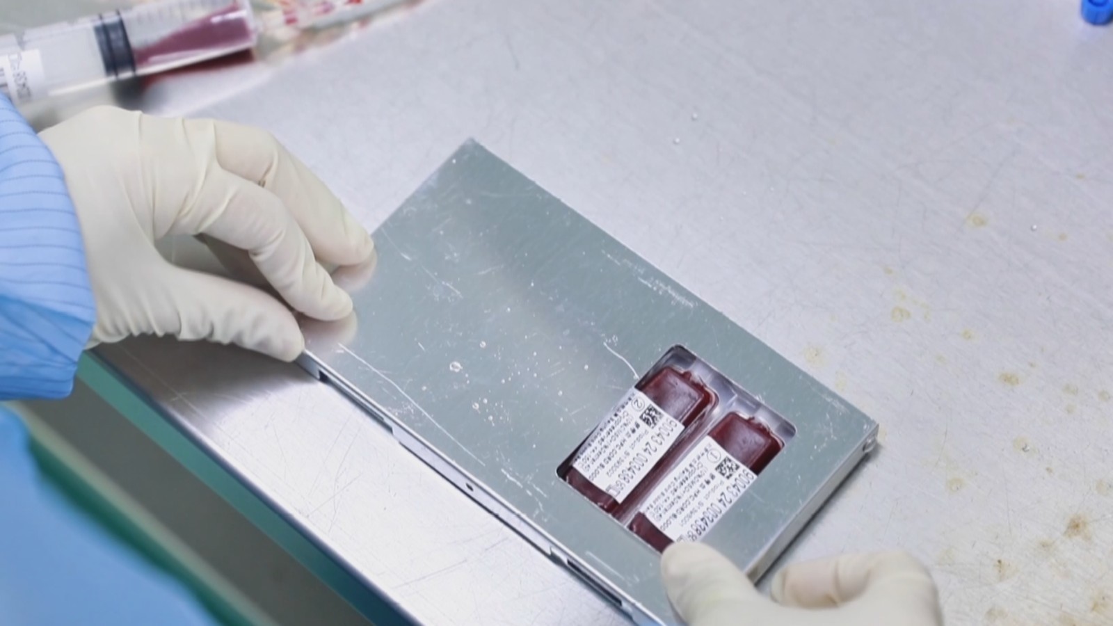 北京市脐带血造血干细胞库储存超过32万份脐带血 救治患者超2300例