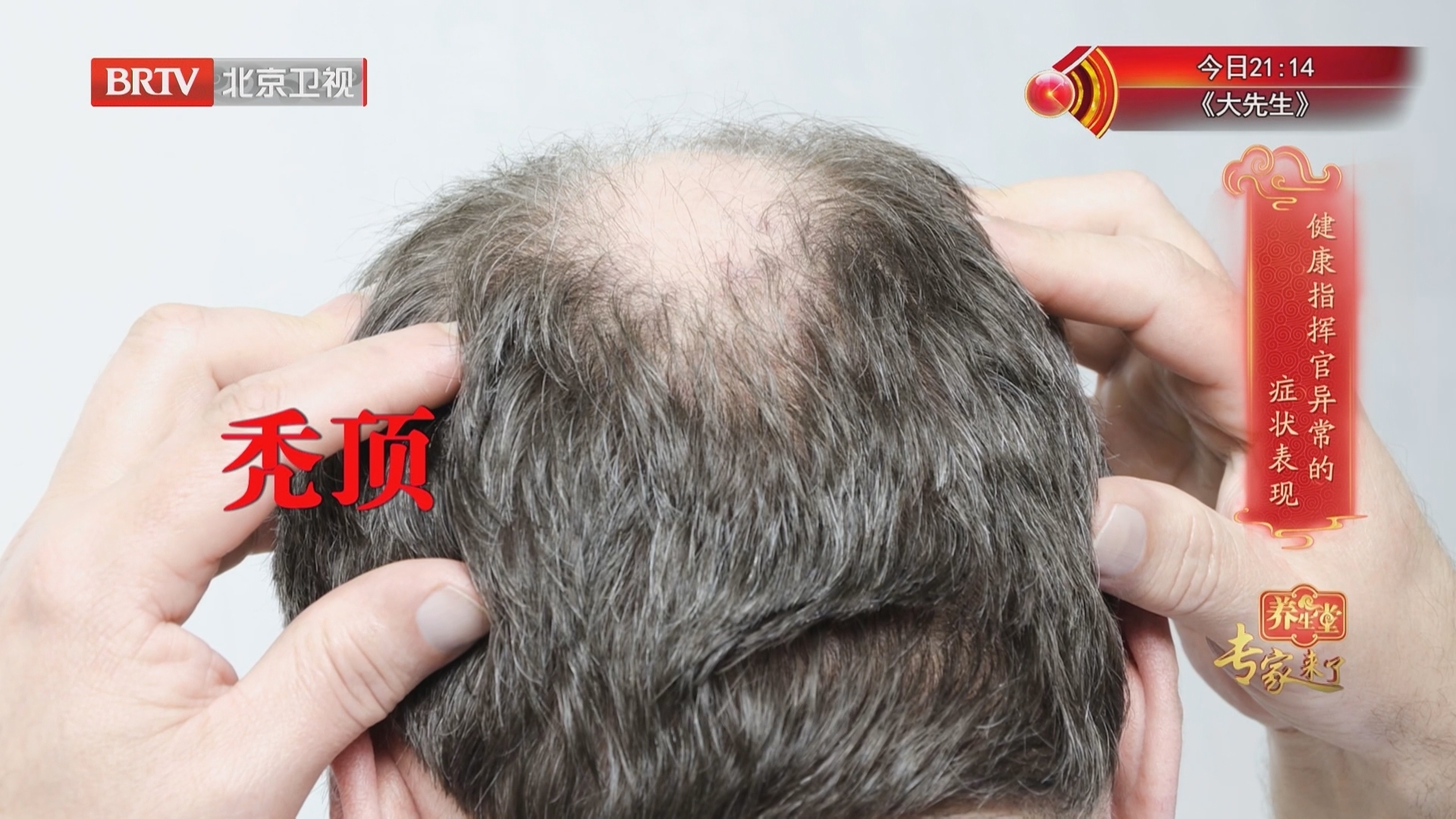 《养生堂》20251028被忽视的健康“指挥官” 《养生堂》20251028被忽视的健康“指挥官”