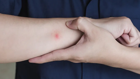 今日科普:蚊子为啥总咬我?这回明白了! 今日科普:蚊子为啥总咬我?这回明白了!