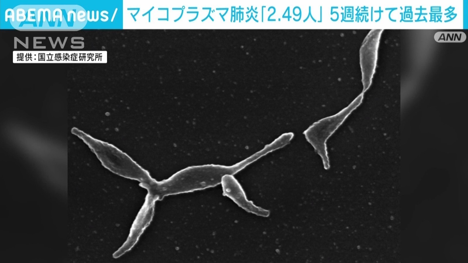 日本支原体肺炎继续流行　平均每家医疗机构2.49例