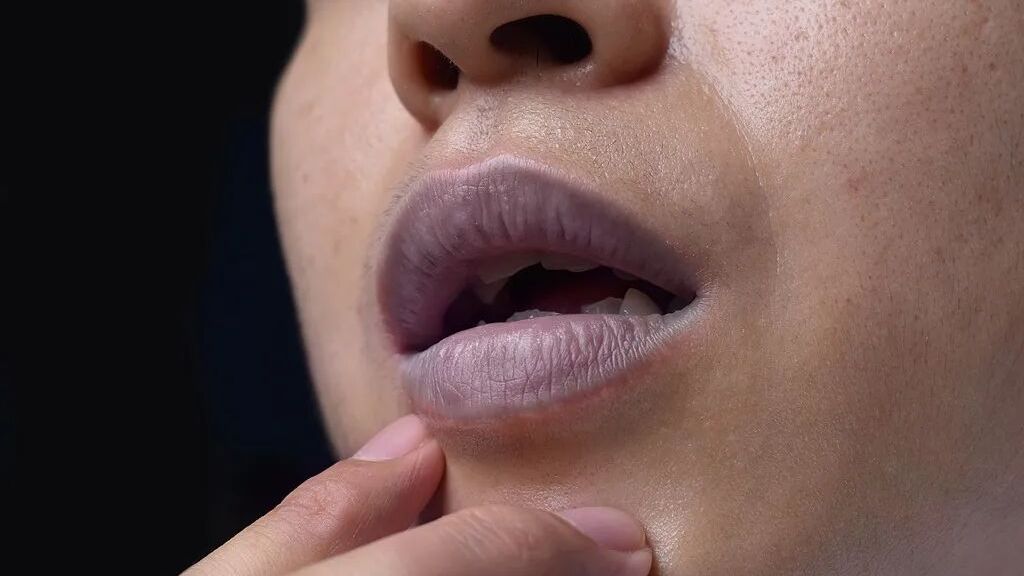 陆毅被网友提醒 “嘴唇发紫” 后去体检，嘴唇发紫是心脏在“求救”吗