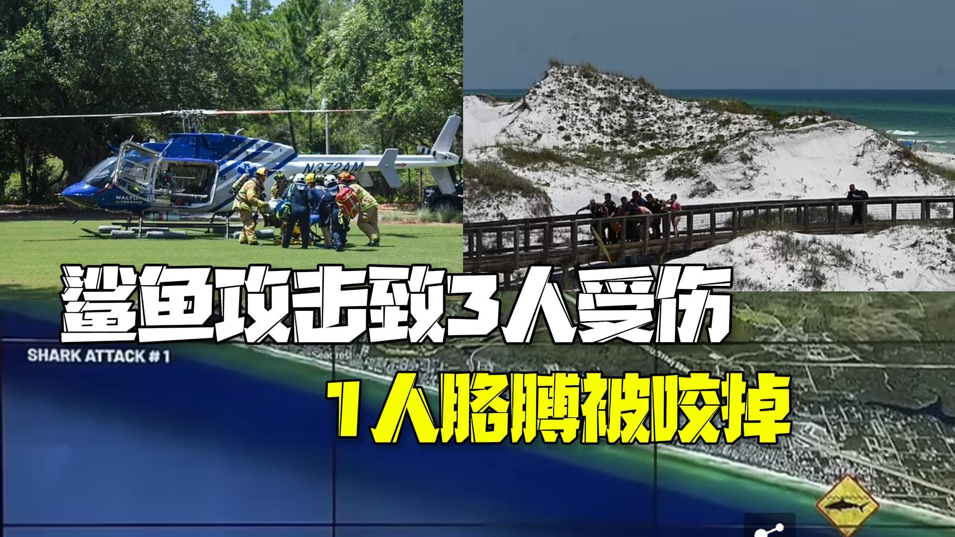 恐怖!美国一海滩一天连发两起鲨鱼袭人 三人受伤一人胳膊被咬掉 恐怖!美国一海滩一天连发两起鲨鱼袭人 三人受伤一人胳膊被咬掉