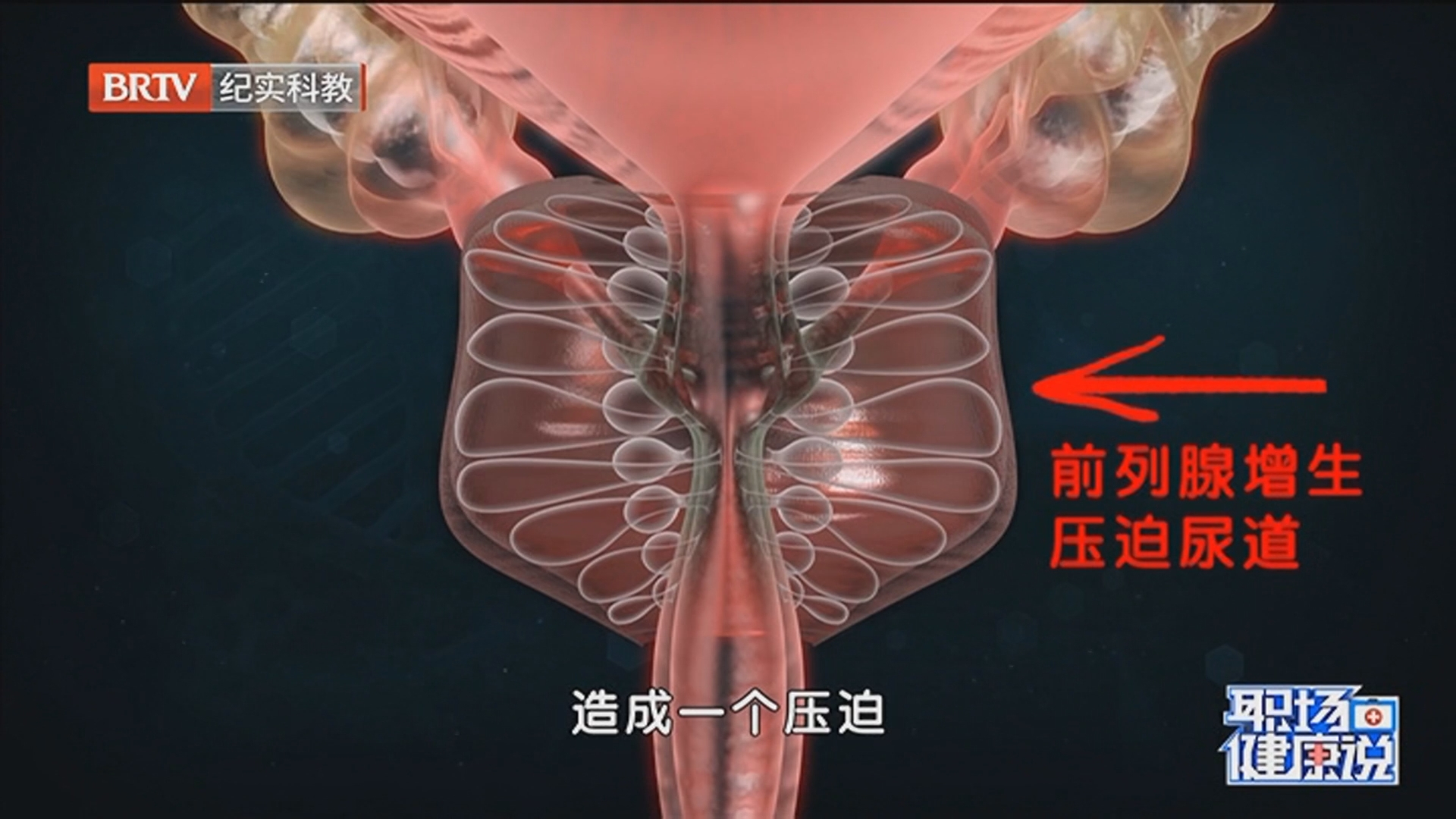 《职场健康说》20260330前列腺位于膀胱下方 是排尿通路的重要器官