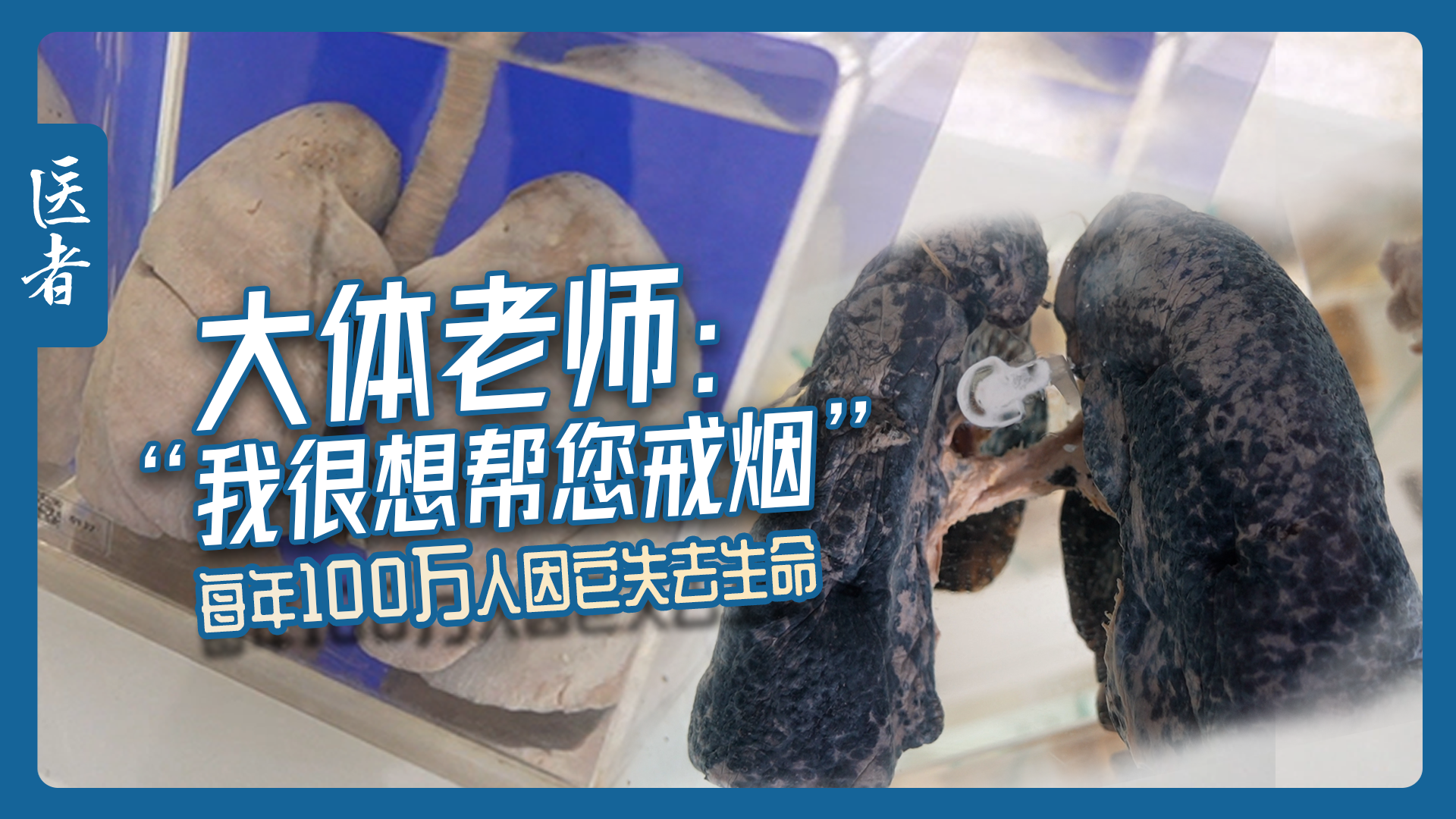 医者|大体老师:“我很想帮您戒烟” 每年100万人因它失去生命 医者|大体老师:“我很想帮您戒烟” 每年100万人因它失去生命