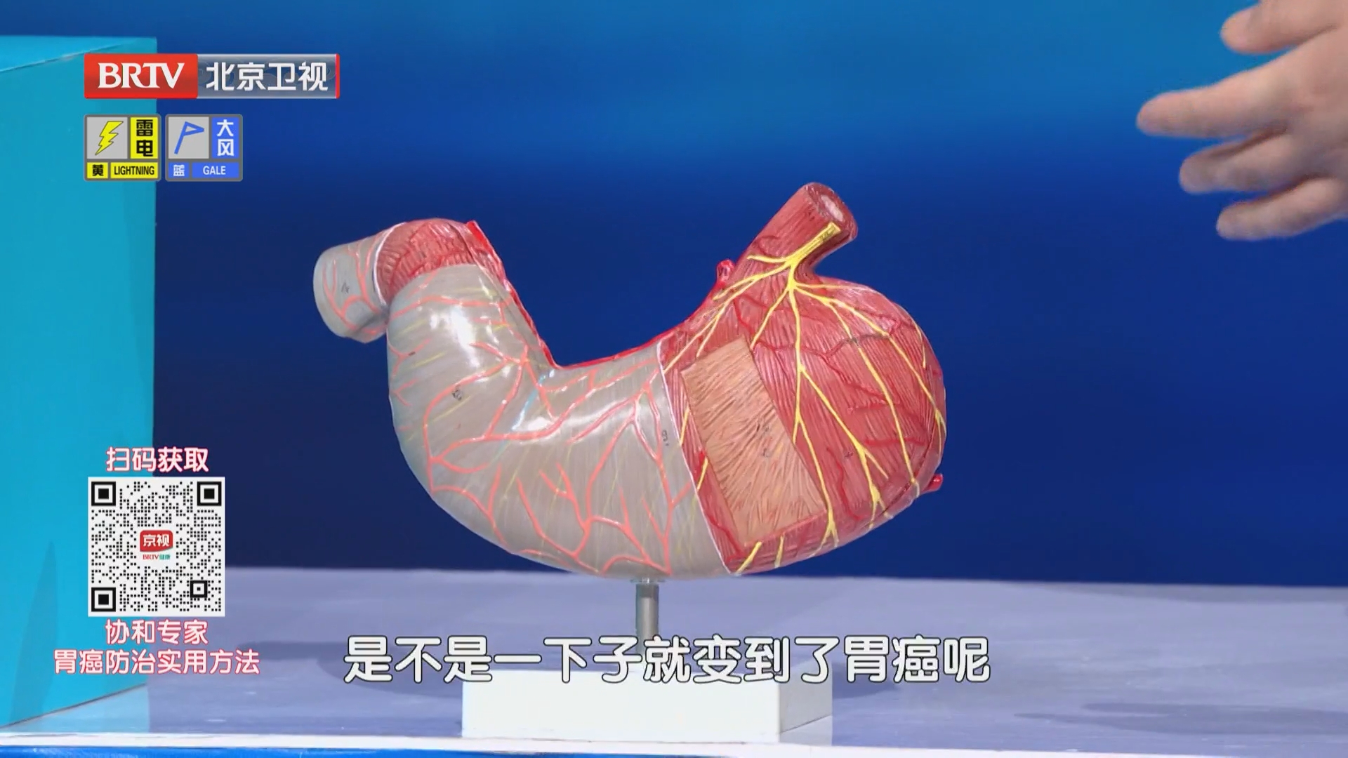 《养生堂》20260622生活没规律 胃癌爱上门