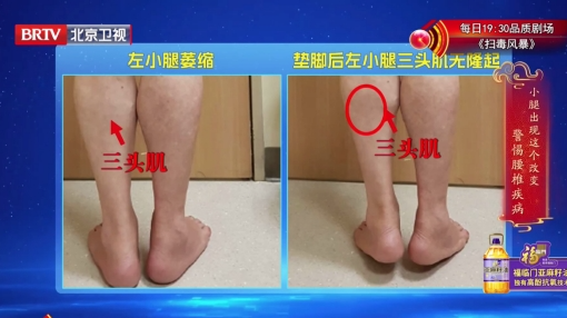 肌无力的持续发展，可能会出现肌肉萎缩
