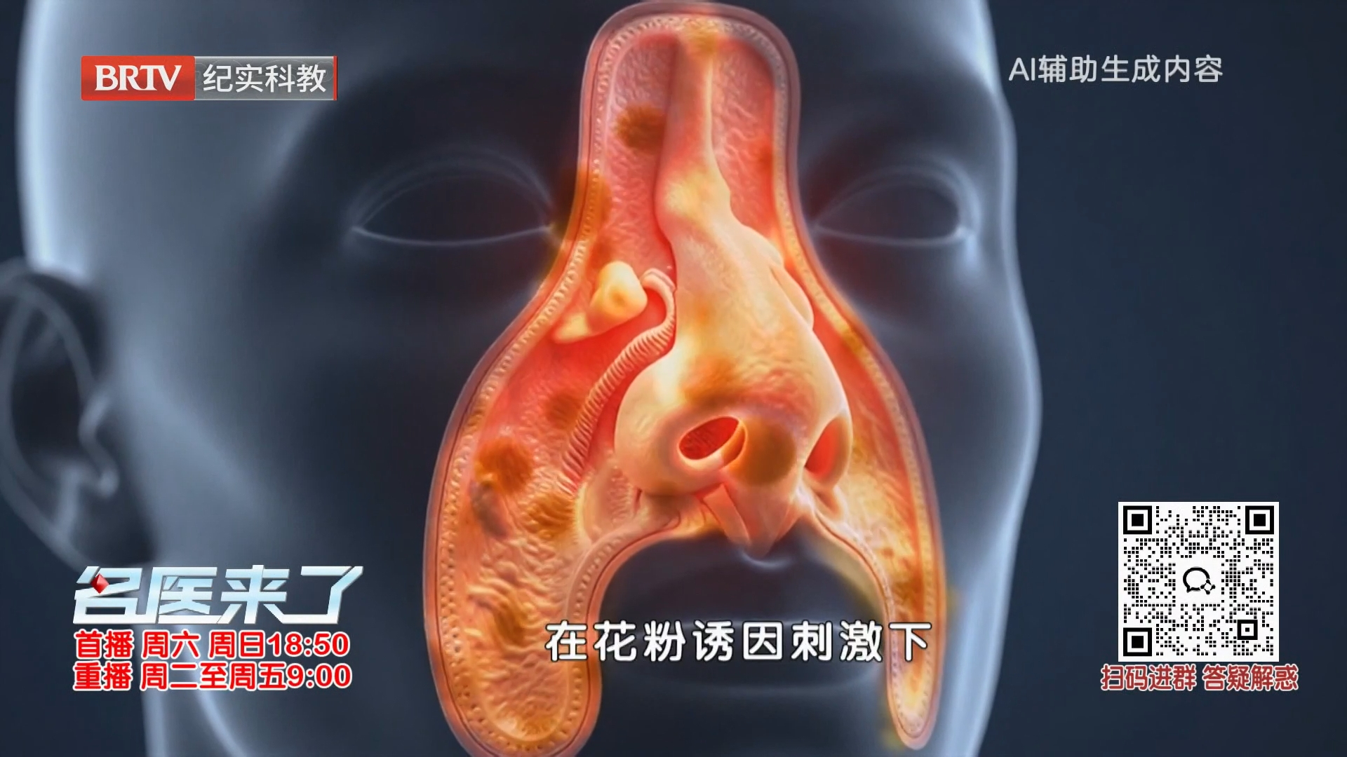 《名医来了》20260912这个秋天给鼻子“松绑”