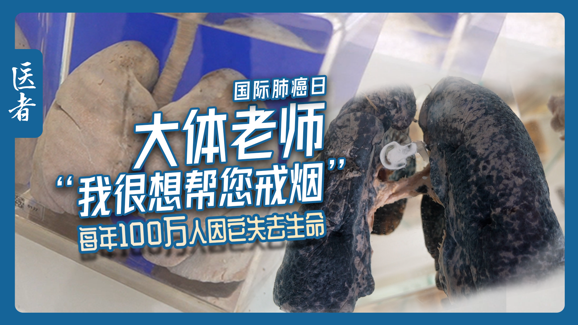 国际肺癌日｜大体老师“我很想帮您戒烟” 每年100万人因它失去生命
