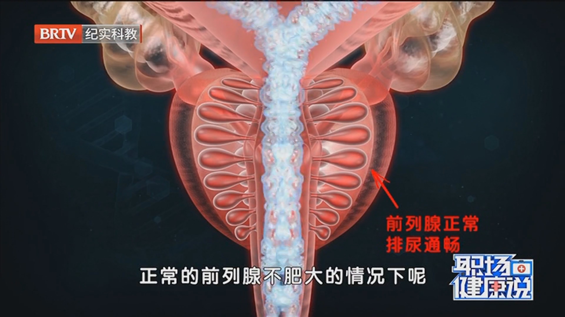 《职场健康说》20260507前列腺增生危害大 导致尿频 尿急 尿等待 尿不尽 《职场健康说》20260507前列腺增生危害大 导致尿频 尿急 尿等待 尿不尽