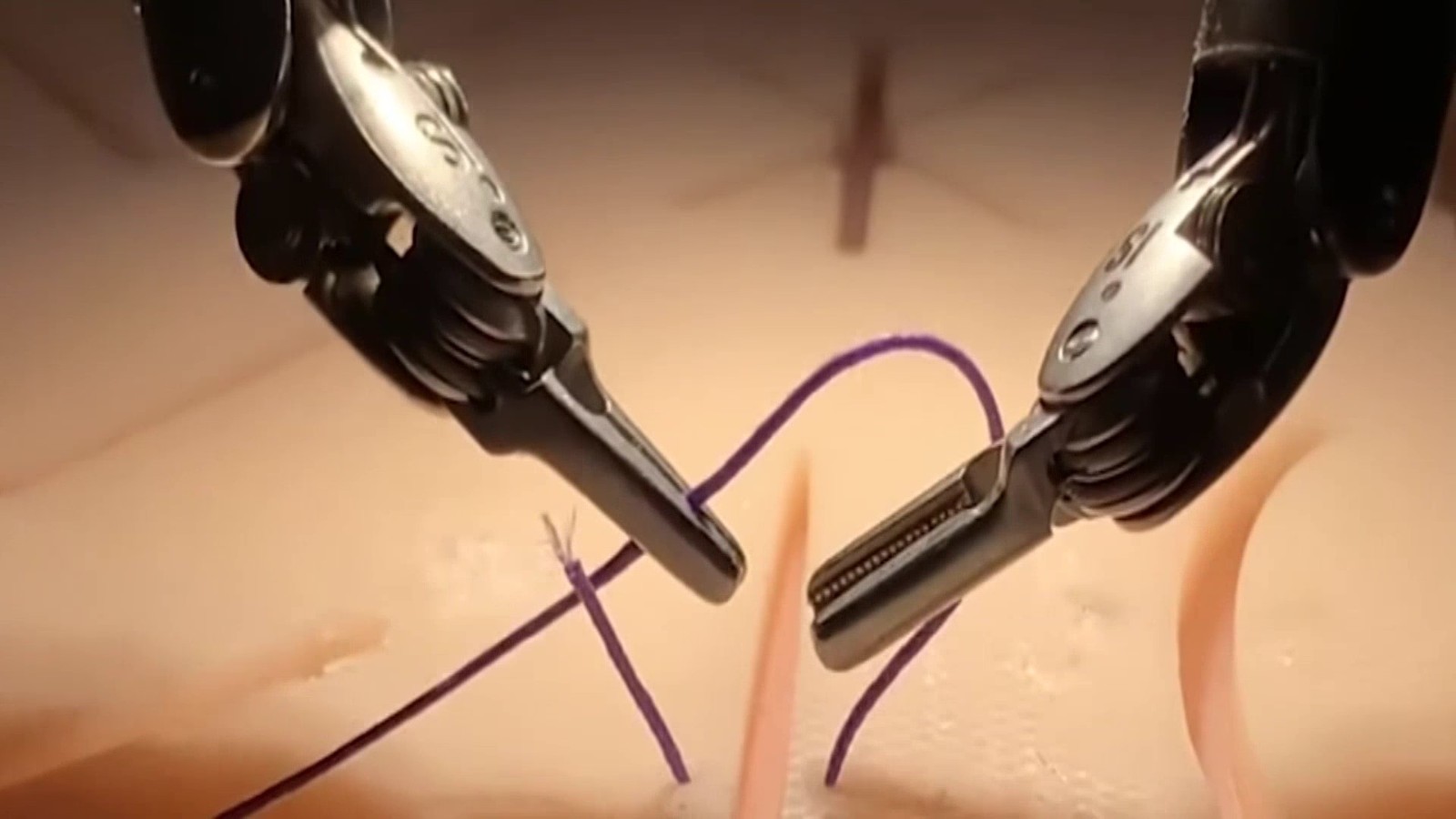 海量模仿加智能学习或能让手术机器人更能干 海量模仿加智能学习或能让手术机器人更能干