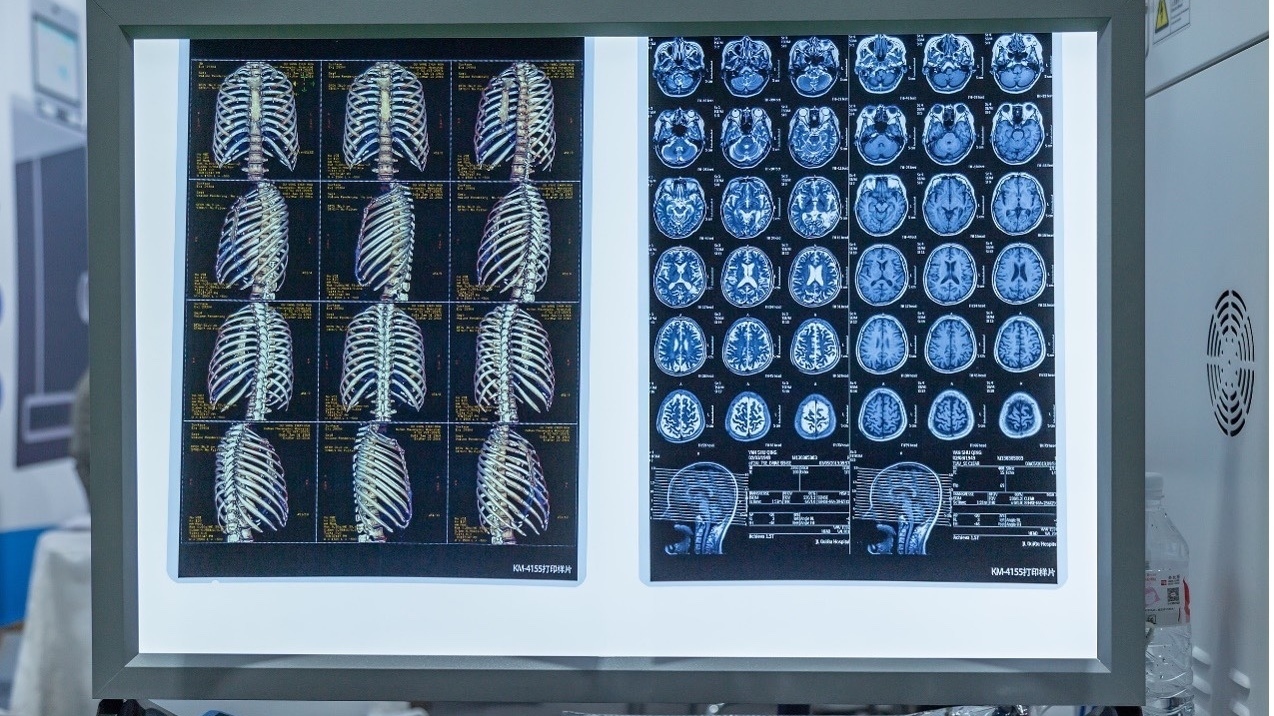 高值医用耗材集采“落地”四年,医患企实现共赢 高值医用耗材集采“落地”四年,医患企实现共赢