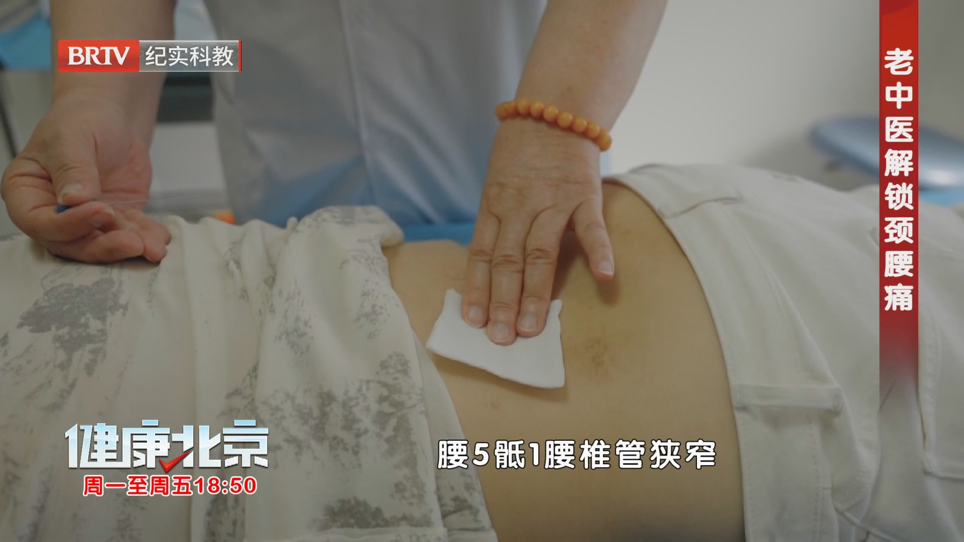 《健康北京》20260819老中医解锁颈腰痛
