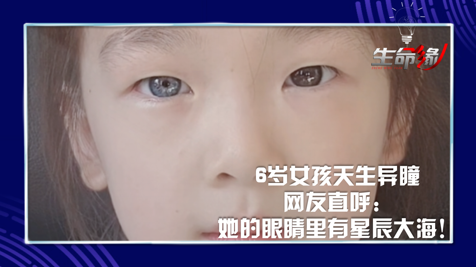 江西上饶，6岁女孩天生异瞳，左眼棕色右眼蓝色
