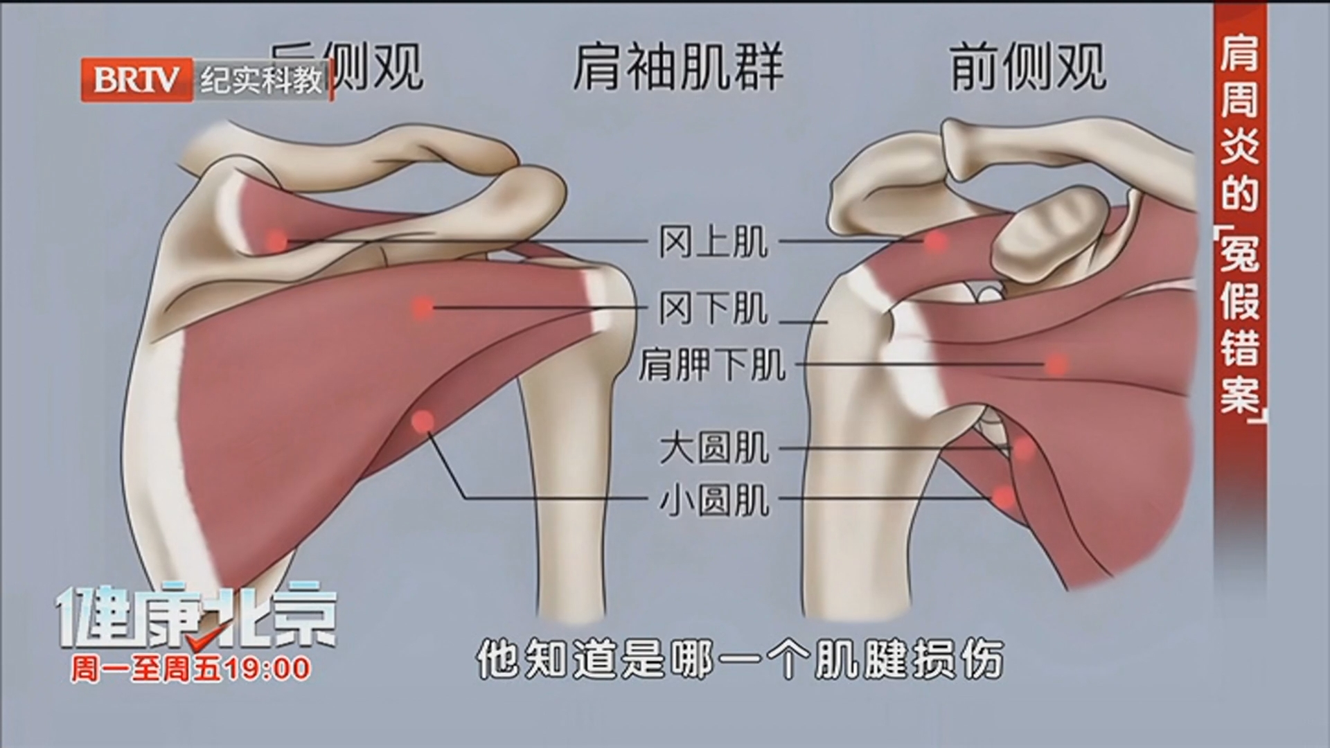 《健康北京》20251204舒针疗法 一针解锁“冻结肩”