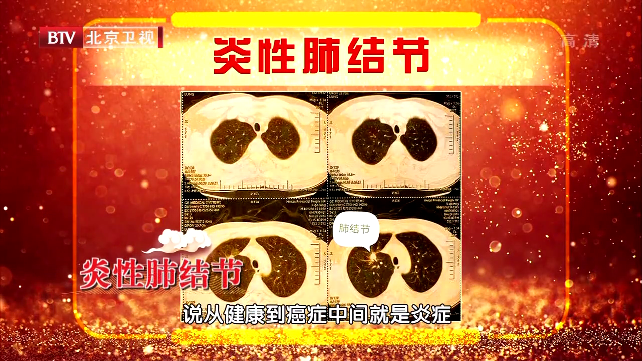 肺主皮毛，肺有问题看皮肤上的症状就知道，快学一学！