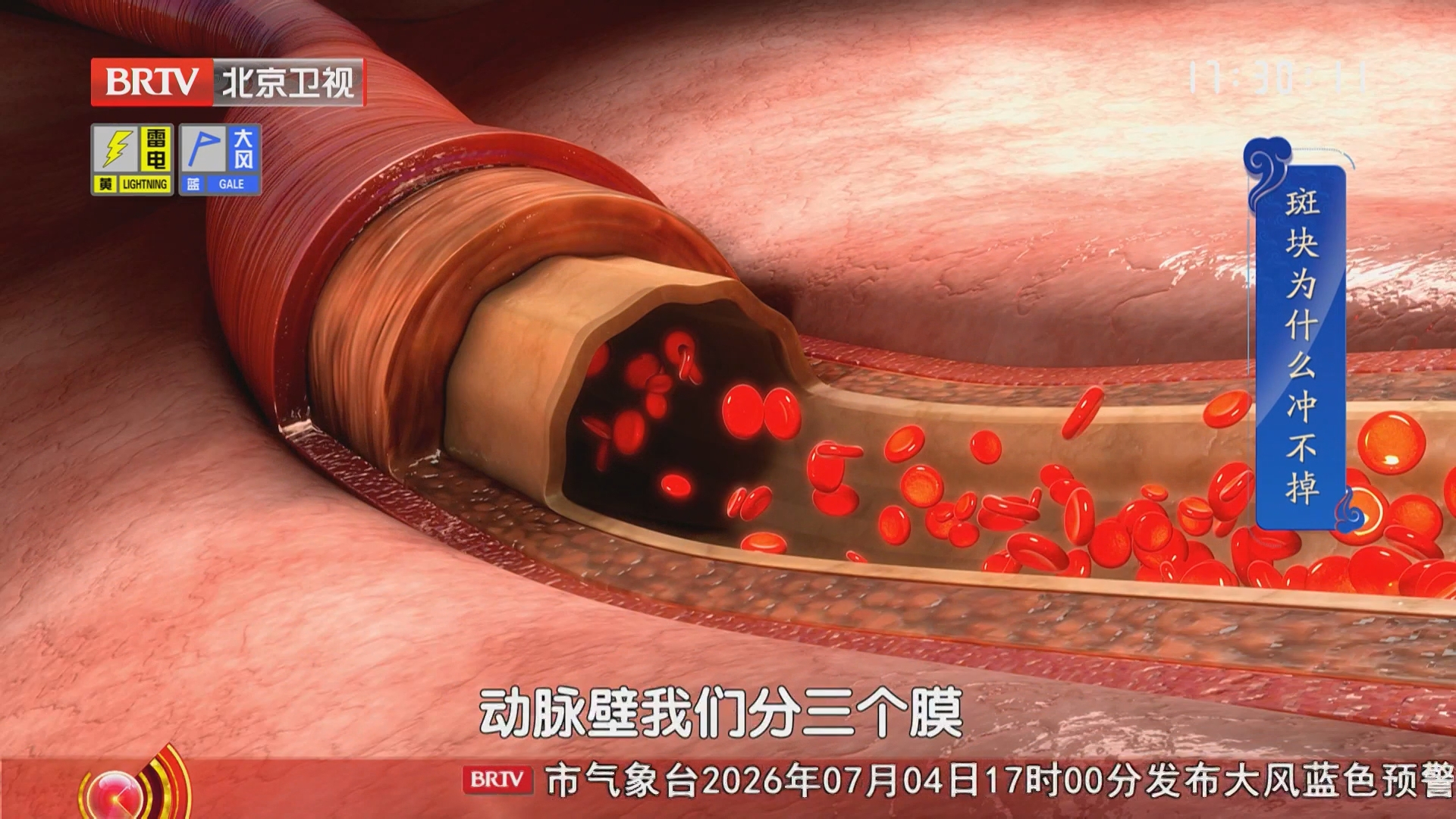 《养生堂》20260704打开身体的健康“说明书”（1）