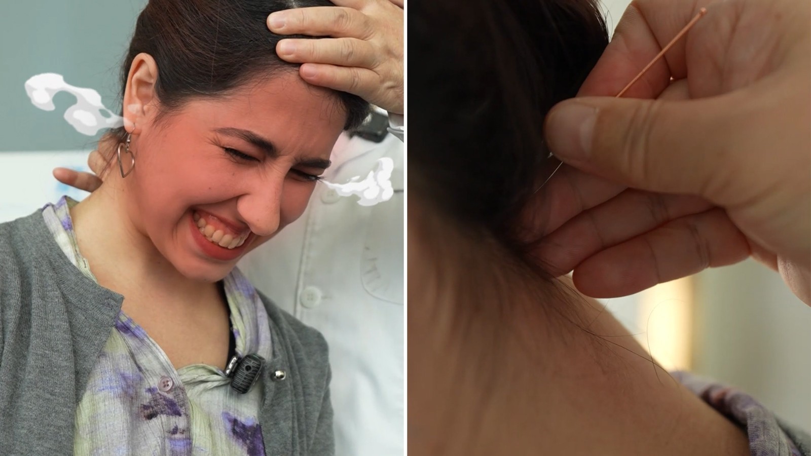 《这様家乡》之怕针星人体验东方魔法“针灸”